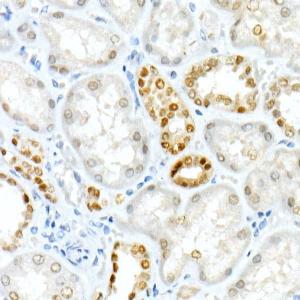 Immunohistochemistry analysis of paraffin-embedded human kidney using Anti-PAX8 Antibody [ARC55538] (A305642) at a dilution of 1:300 (40x lens) Perform high pressure antigen retrieval with 10 mM citrate buffer pH 60 before commencing with IHC staining protocol