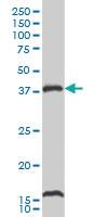 Anti-CAMK1 Mouse Monoclonal Antibody [clone: 2B6]