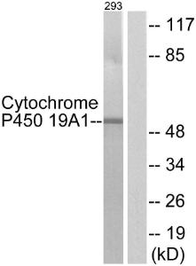 Western blot analysis of lysates from 293 cells using Anti-Cytochrome P450 19A1 Antibody. The right hand lane represents a negative control, where the antibody is blocked by the immunising peptide.