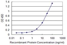 Anti-PKNOX1 Mouse Monoclonal Antibody [clone: 1F12]