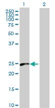 Anti-RAB34 Mouse Polyclonal Antibody