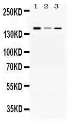 Anti-ADAMTS13 Rabbit Polyclonal Antibody