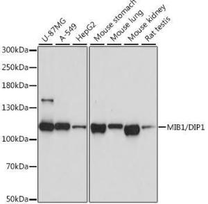 Antibody anti-MIB1 100 µl