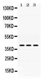 Anti-ADH1A Rabbit Polyclonal Antibody