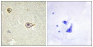 Immunohistochemical analysis of paraffin-embedded human brain tissue using Anti-Cytochrome P450 19A1 Antibody. The right hand panel represents a negative control, where the antibody was pre-incubated with the immunising peptide.