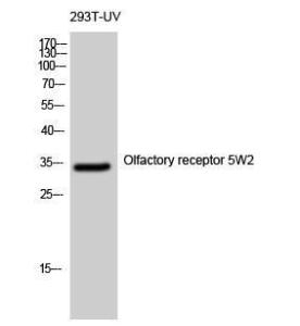 Western blot analysis of 293T UV cells using Anti-OR5W2 Antibody