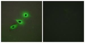 Immunofluorescence analysis of A549 cells using Anti-Cytochrome P450 19A1 Antibody. The right hand panel represents a negative control, where the antibody was pre-incubated with the immunising peptide.