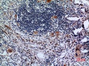 Immunohistochemical analysis of paraffin-embedded human lung using Anti-TFRC Antibody