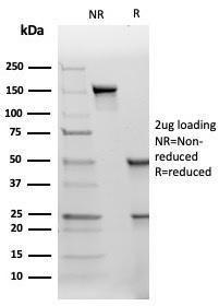 SDS-PAGE analysis of Anti-TIMP2 Antibody [TIMP2/4477] under non-reduced and reduced conditions; showing intact IgG and intact heavy and light chains, respectively. SDS-PAGE analysis confirms the integrity and purity of the antibody.