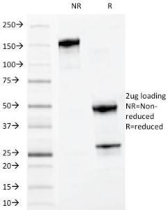 SDS-PAGE analysis of Anti-MYADM Antibody [MYADM/972] under non-reduced and reduced conditions; showing intact IgG and intact heavy and light chains, respectively. SDS-PAGE analysis confirms the integrity and purity of the antibody