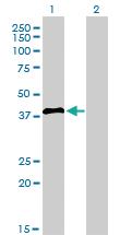 Anti-IRF2 Mouse Monoclonal Antibody [clone: 3B5]