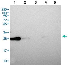 Anti-CHCHD6 Rabbit Polyclonal Antibody