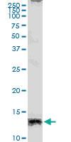 Anti-CXCL13 Polyclonal Antibody Pair