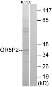 Western blot analysis of lysates from HUVEC cells using Anti-OR5P2 Antibody. The right hand lane represents a negative control, where the antibody is blocked by the immunising peptide.