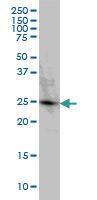 Anti-PGRMC2 Mouse Monoclonal Antibody [clone: 3C11]