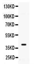 Anti-ADK Rabbit Polyclonal Antibody