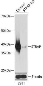 Western blot analysis of extracts from normal (control) and STRAP knockout (KO) 293T cells, using Anti-Unrip Antibody (A306945) at 1:1000 dilution