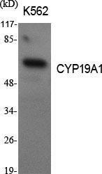 Western blot analysis of various cells using Anti-Cytochrome P450 19A1 Antibody