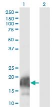 Anti-CARHSP1 Mouse Monoclonal Antibody [clone: 4G10]