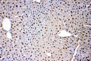 Anti-ADK Rabbit Polyclonal Antibody