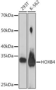 Western blot analysis of extracts of various cell lines, using Anti-HOXB4 Antibody [ARC2236] (A306946) at 1:1,000 dilution. The secondary antibody was Goat Anti-Rabbit IgG H&L Antibody (HRP) at 1:10,000 dilution.