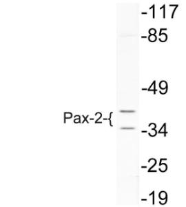 Anti-Pax2 Rabbit Polyclonal Antibody