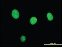 Anti-STK33 Mouse Monoclonal Antibody [clone: 4A12]