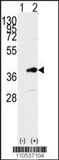 Anti-PBK Rabbit Polyclonal Antibody (HRP (Horseradish Peroxidase))