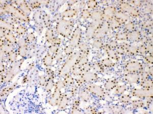 Anti-ADK Rabbit Polyclonal Antibody