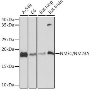 Western blot analysis of extracts of various cell lines, using Anti-NM23A Antibody [ARC1309] (A306947) at 1:1,000 dilution