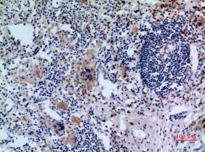 Immunohistochemical analysis of paraffin-embedded human lung using Anti-TFRC Antibody