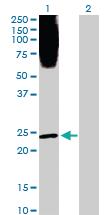 Anti-PLA2G1B Rabbit Polyclonal Antibody