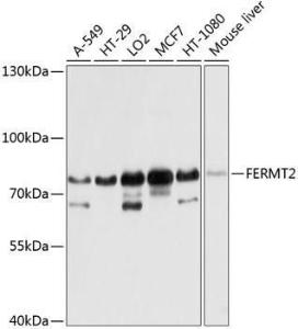 Western blot analysis of extracts of various cell lines, using Anti-Kindlin 2 Antibody (A12294) at 1:1,000 dilution. The secondary antibody was Goat Anti-Rabbit IgG H&L Antibody (HRP) at 1:10,000 dilution.