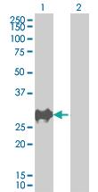 Anti-CDKN1B Mouse Polyclonal Antibody