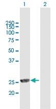 Anti-MPHOSPH8 Mouse Polyclonal Antibody