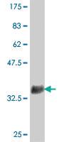 Anti-ZNF598 Mouse Polyclonal Antibody