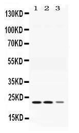 Anti-AK1 Rabbit Polyclonal Antibody