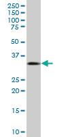 Anti-CDKN1B Mouse Polyclonal Antibody