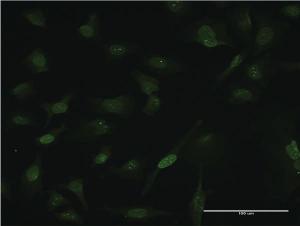 Anti-CARHSP1 Mouse Monoclonal Antibody [clone: 4G10]