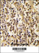 Anti-DNMT3A Rabbit Polyclonal Antibody