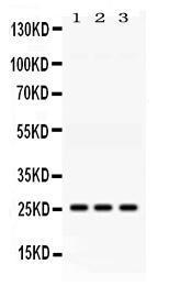 Anti-AK2 Rabbit Polyclonal Antibody