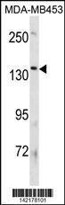 Anti-ATP8B3 Rabbit Polyclonal Antibody (FITC (Fluorescein Isothiocyanate))