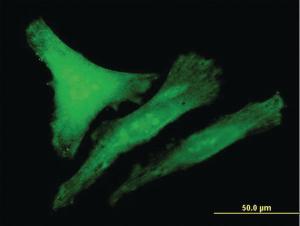 Anti-CDKN1B Mouse Polyclonal Antibody