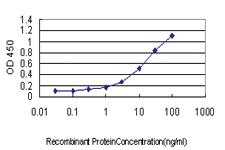 Anti-PLA2G4A Mouse Monoclonal Antibody [clone: 10G5]