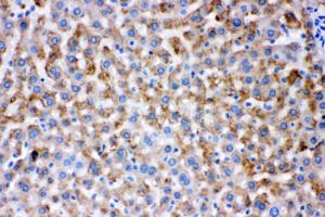 Anti-AK2 Rabbit Polyclonal Antibody