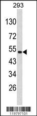 Anti-PLEKHO1 Rabbit Polyclonal Antibody