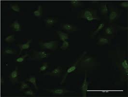 Anti-CARHSP1 Mouse Monoclonal Antibody [clone: 4G10]