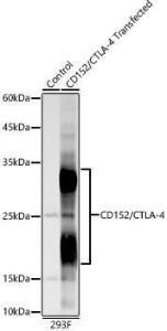 Anti-CTLA4 Rabbit Monoclonal Antibody [clone: ARC57390]