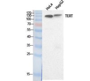 Western blot analysis of extracts from HeLa, HepG2 cells using Anti-TERT Antibody