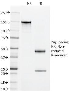 SDS-PAGE analysis of Anti-CD55 Antibody [143-30] under non-reduced and reduced conditions; showing intact IgG and intact heavy and light chains, respectively. SDS-PAGE analysis confirms the integrity and purity of the antibody